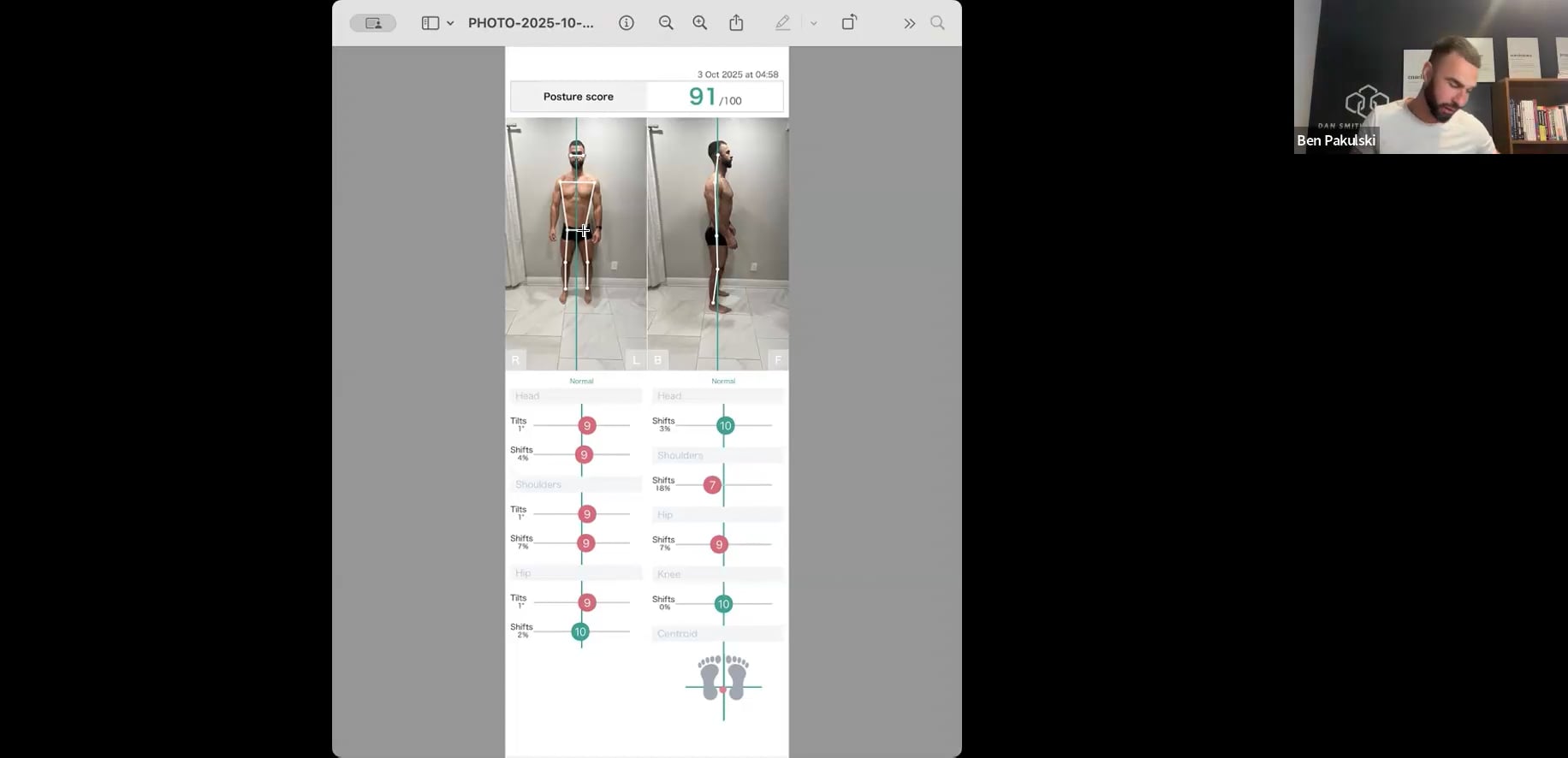 Oct 08 '25 | TRANSFORMATION SPOTLIGHT: MATT DIXON - BIOMECHANICS